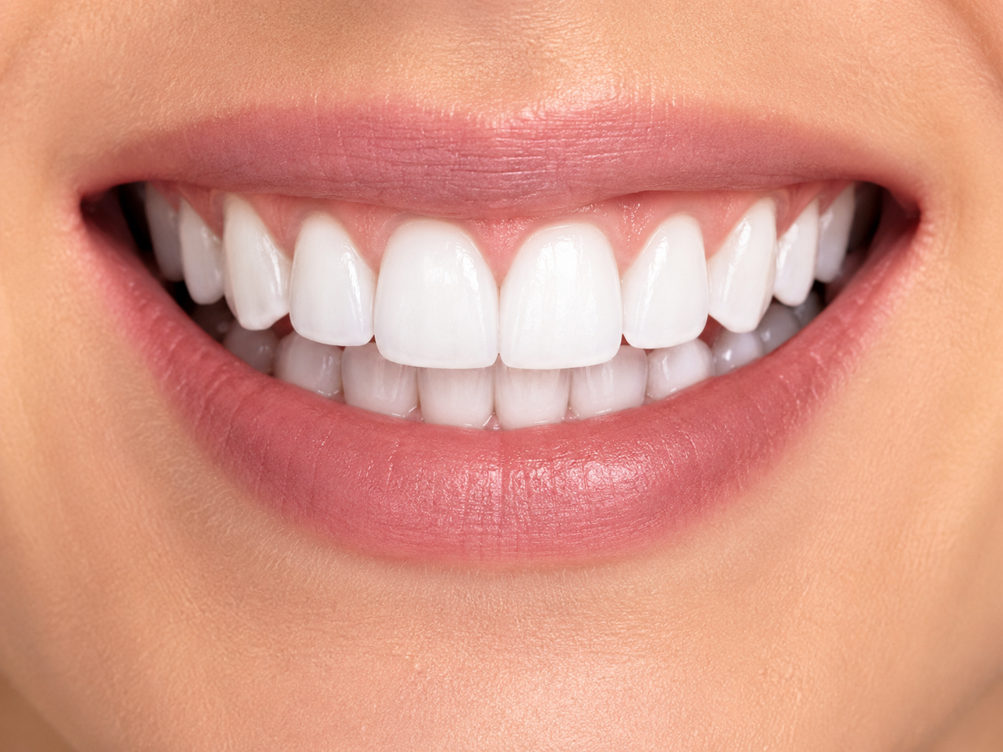 Lentes de Contato Dental — depois